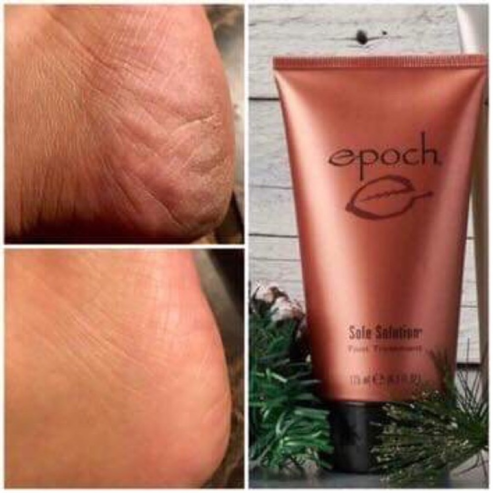 NuSkin Sole Solution
